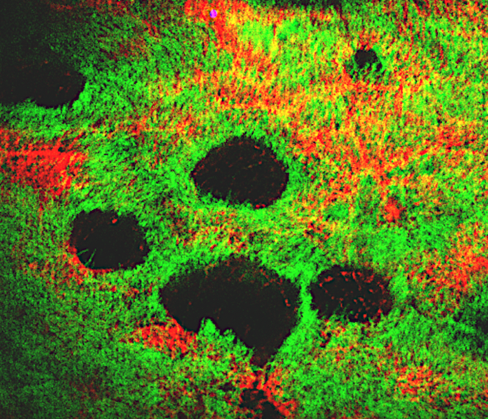 Confocal image of ALI cells