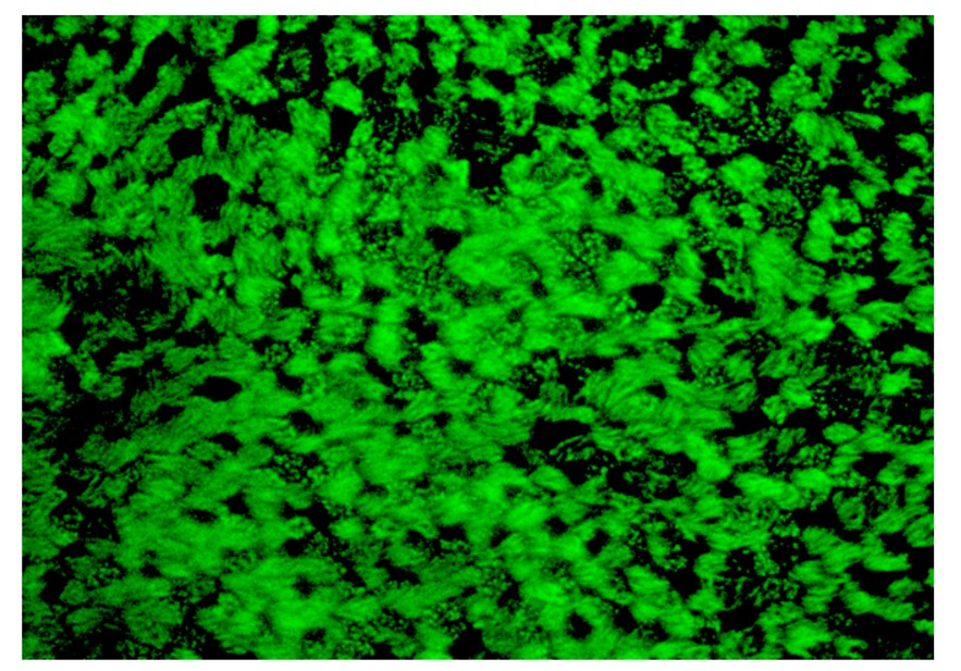 ALI transwell immunostainign showing cilia