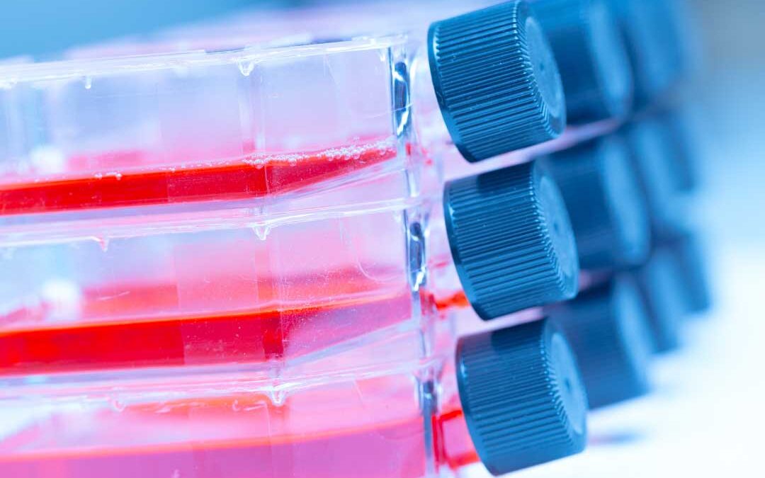 How to Choose the Right In Vitro Model for an Antiviral Study