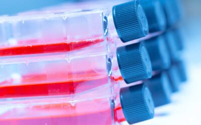How to Choose the Right In Vitro Model for an Antiviral Study
